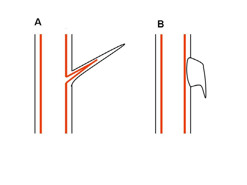 [0]thorn_prickle.jpg